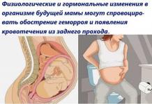 Симптомы, лечение и профилактика геморроя при беременности