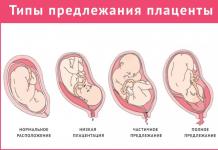 Виділення коричневого кольору при вагітності