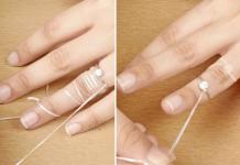 نصيحة الجراح: كيفية إزالة الخاتم من إصبع منتفخ؟